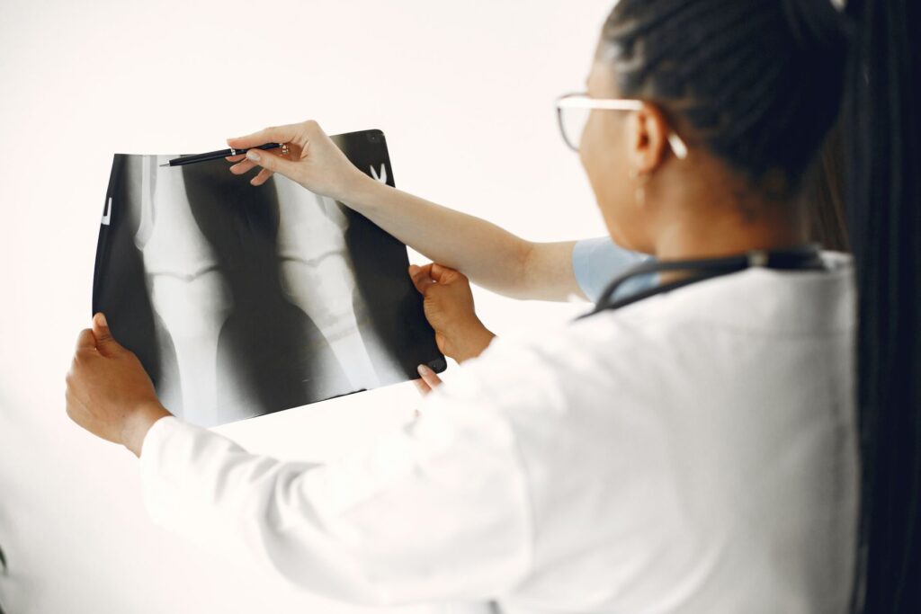 manifestation du cancer des os chez la personne âgée par une fracture importante